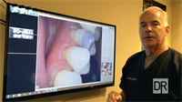 Case Study: Answering Questions about Silver Fillings and Gum Recession