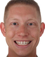 #SmileStories: Using Photography in Case Presentation