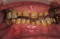 Dr. John Nosti - A Survivor's Case Study