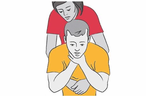  Foreign Object Blocked Airway Conscious (Adult)