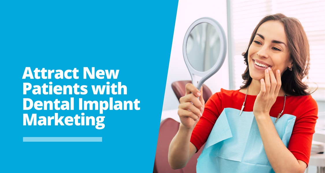 The Top Dental Implant Marketing Strategies of 2024