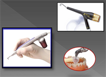 Good Vibrations About Air Abrasion Technology