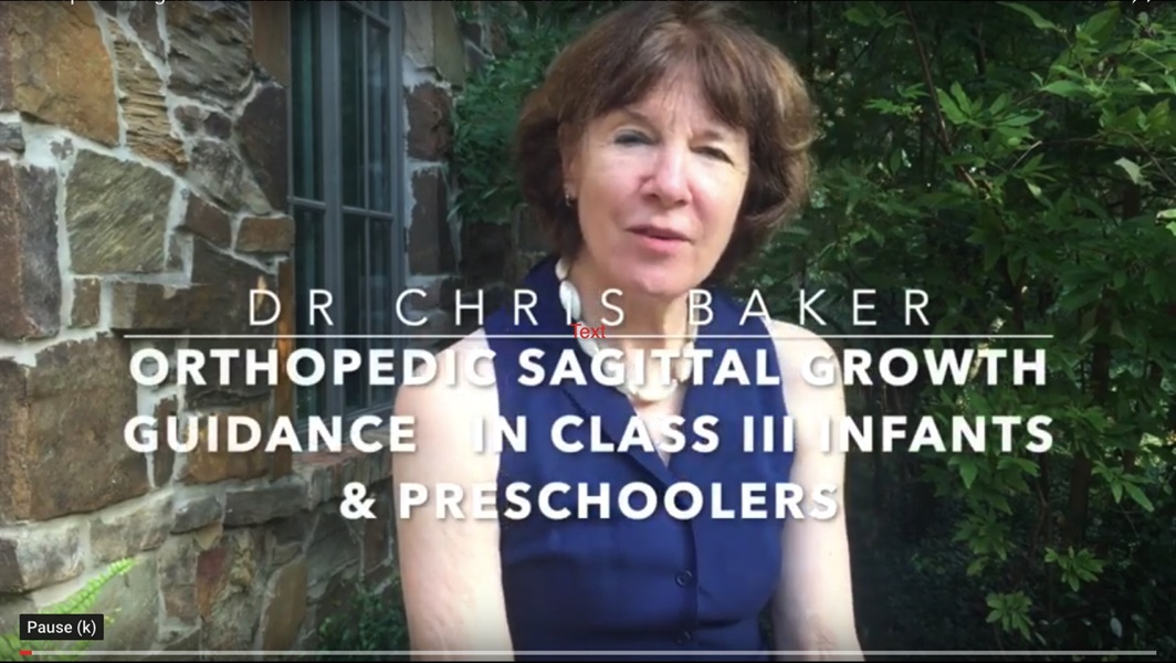 Orthopedic Sagittal Growth Guidance in Class III Infants & Preschoolers