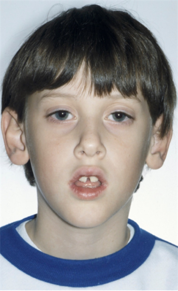  WOW!!!  We’re talkin’ about airway issues in children (at last).