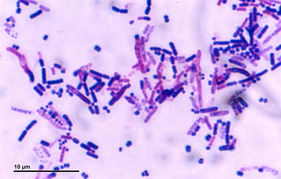 What do you tell your patients (or their parents) about their bad breath?