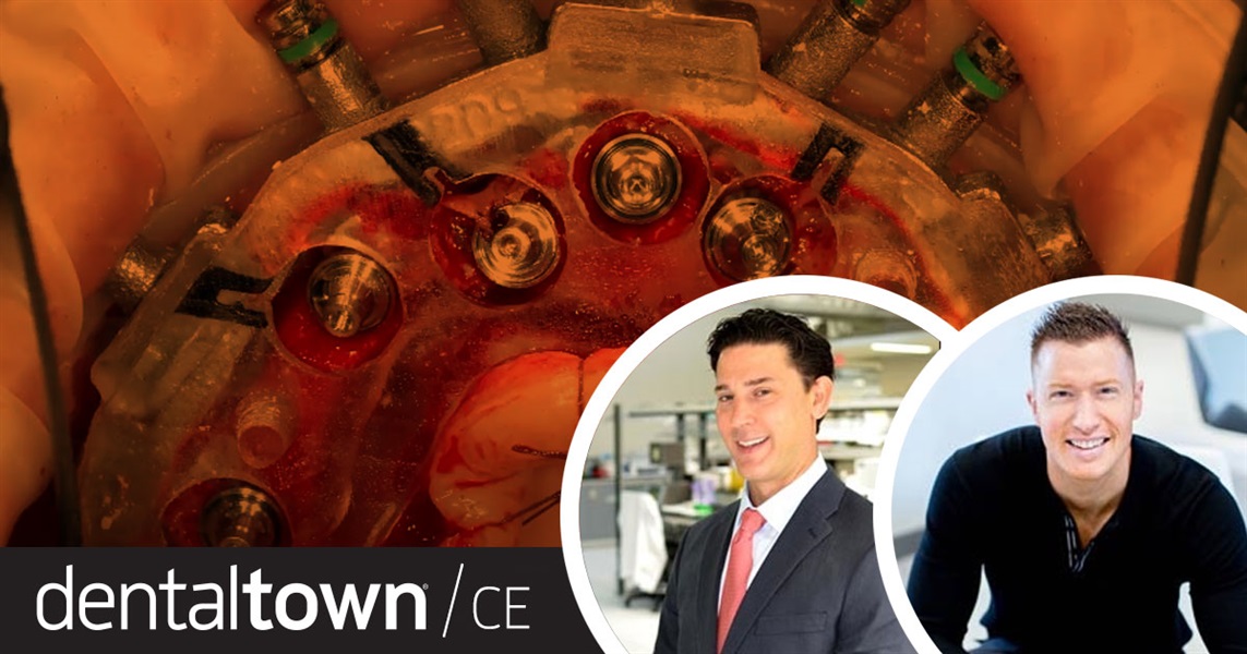 Dentaltown Learning Online....The Fixed Full Arch for Everyone: The Solution for Underserved Patient Communities. By BJ Kowalski and Dr. Grant Olson.