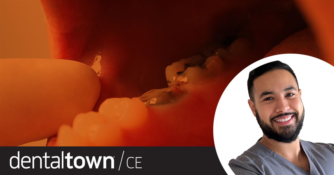 Dentaltown Learning Online...Know How To Manage Dental Traumas. By Dr. Badr Hefnawi