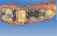 Dentaltown Learning Online- "Current Tips and Tricks of Cerec Tools and Biocopy" by Dr. Mark McClure.