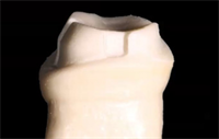 Dentaltown Learning Online... Lane Ochi's "Fundamentals of Fixed Prosthodontics" 
