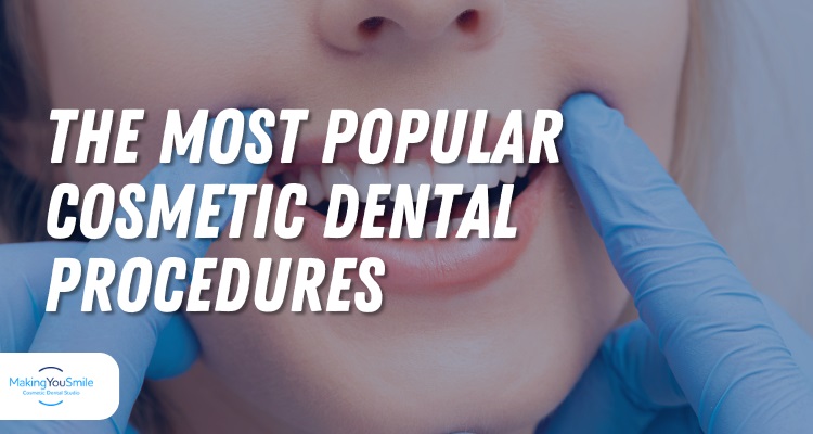 The Most Popular Cosmetic Dental Procedures