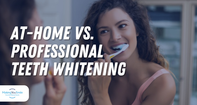 At-Home vs. Professional Teeth Whitening