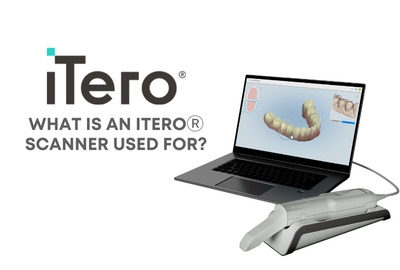 What Is an iTero® Scanner Used for?