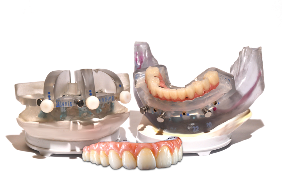 35 NSequence Full Arch Conversion Protocol with Charles Fanlow