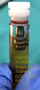 MONONOBLOCK IMPLANT DIAMETER 9 MM. IMPLANTES VALLADOLID, DR  ANTONIO REY GIL