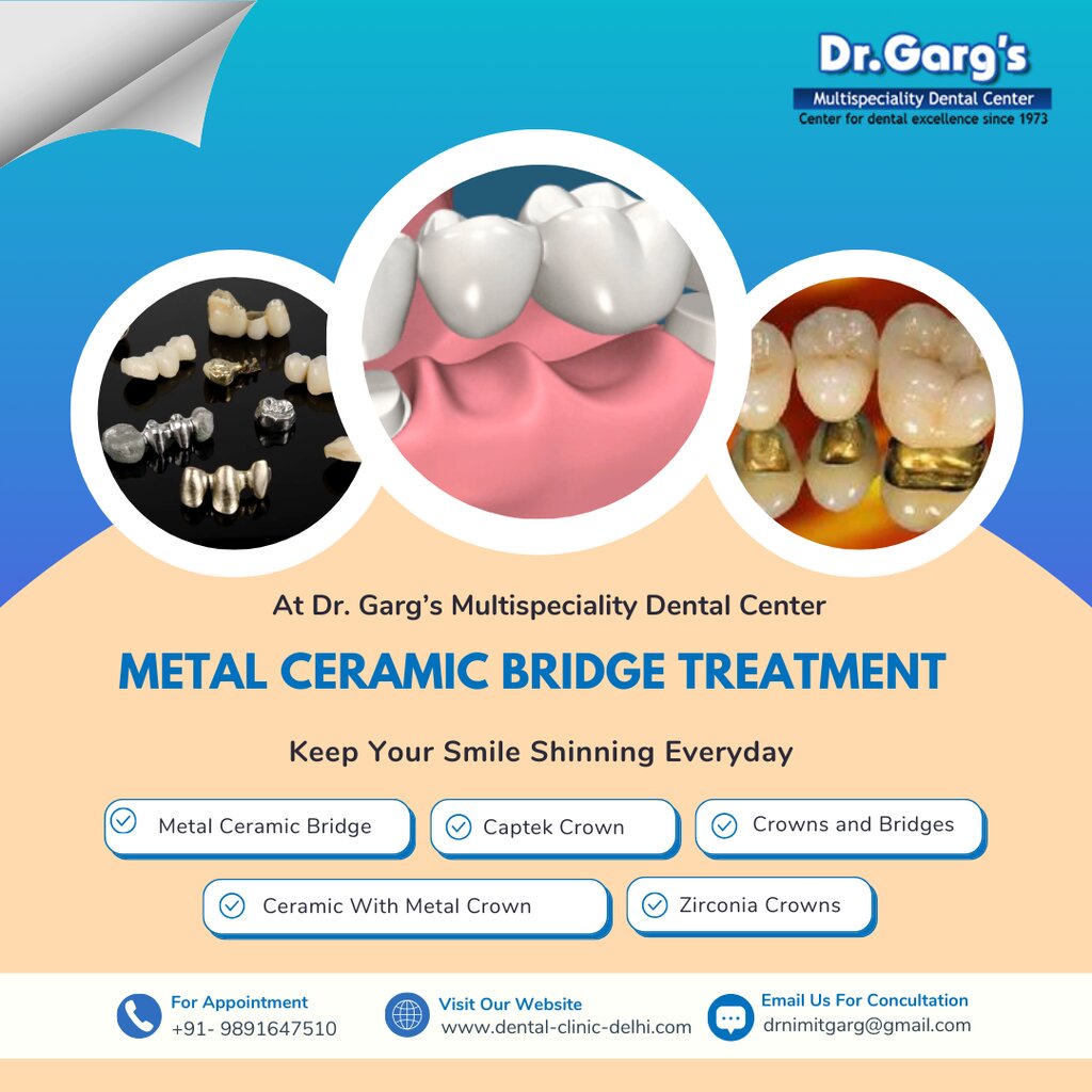 Metal Ceramic Bridge Treatment at Dr. Garg’s Multispeciality Dental Center