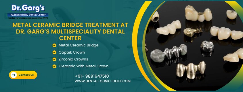 Metal Ceramic Bridge Treatment at Dr. Garg’s Multispeciality Dental Center