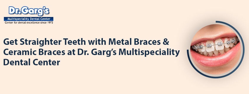 Get Straighter Teeth with Metal Braces and Ceramic Braces at Dr. Garg’s Multispeciality Dental Center