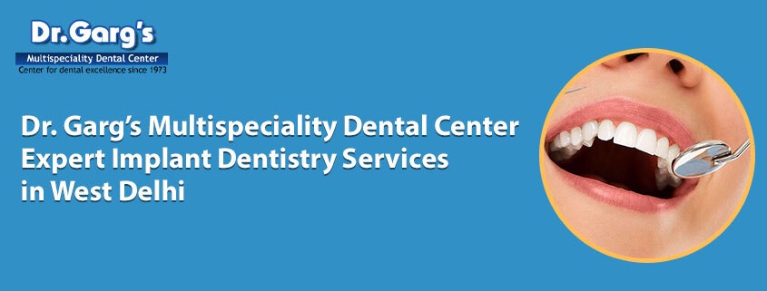Dr. Garg’s Multispeciality Dental Center – Expert Implant Dentistry Services in West Delhi