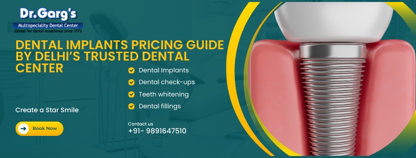 Dental Implants Pricing Guide by Delhi’s Trusted Dental Center