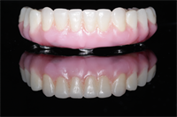 "All on 4" Celebrity Impact!