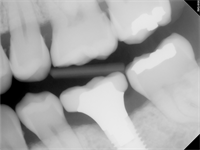 "Emergence Profile": or lack of one