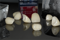 Full Mouth Rehab Video Secrets!!