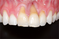 When Plan "A" Doesn't Work Out