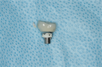 Don't Let Cement Ruin Your Implant 