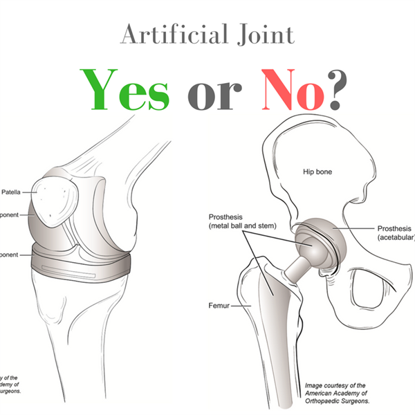 Antibiotic Prophylaxis [Summary]