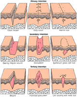 Which repair process describes healing with minimal scaring?