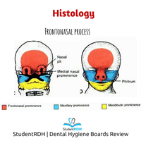 The upper face is formed from the: