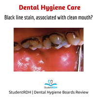 Q: A black line stain is generally related to: