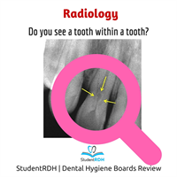 Q: The arrows are pointing at: