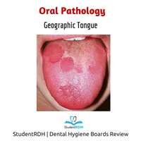 Q: The patient in the photo has: