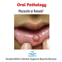 Q: This type of swelling is a(n):