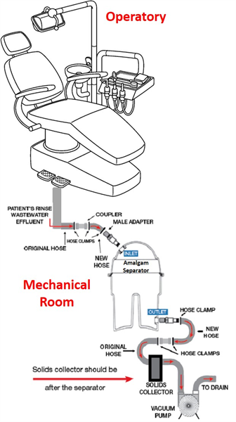 M.A.R.S Answers the Question “What is an Amalgam Separator?” – Part 2