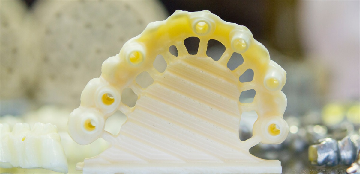 Keep it Dental: Who is supporting your CAD/CAM system?