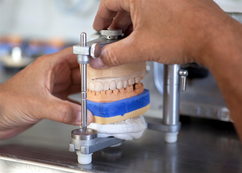 Dental Laboratory Part 2: Traditional Models with a Digital In-House Laboratory