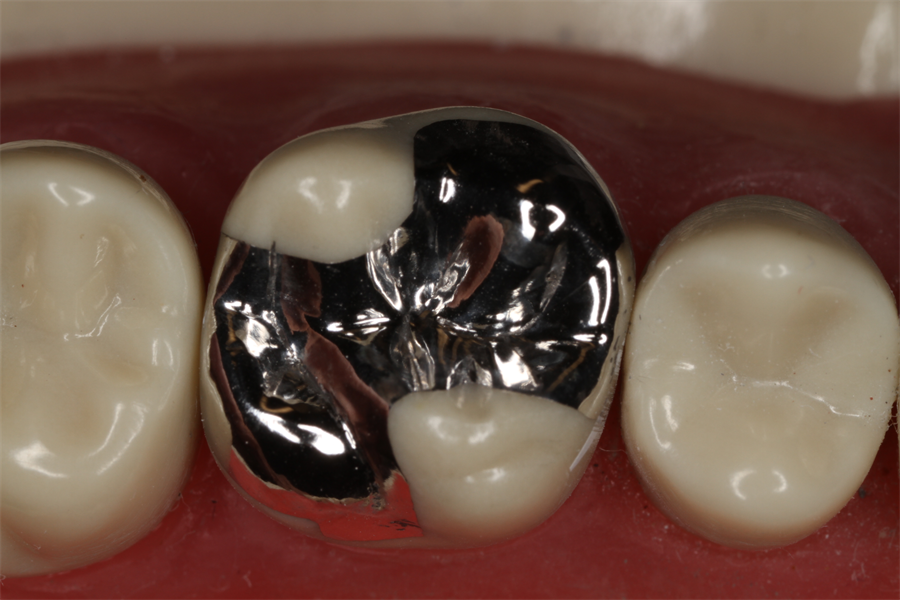 Awesome Amalgam Finish