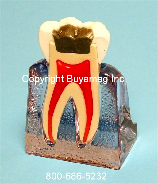 Buyamag's Endodontic Models great tools for endodontic practicing, patients demonstratio, practice increase for dental professionals who specialise endodontic procedures. 