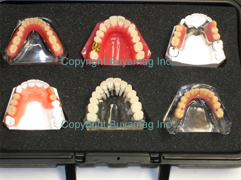 BUYAMAG INC OFFER DENTIST PRACTICE INCREASER 6 MODELS SET. SHOWS PATIENTS EXACTLY HOW THE COMPLETE DENTAL WORK LOOKS LIKE