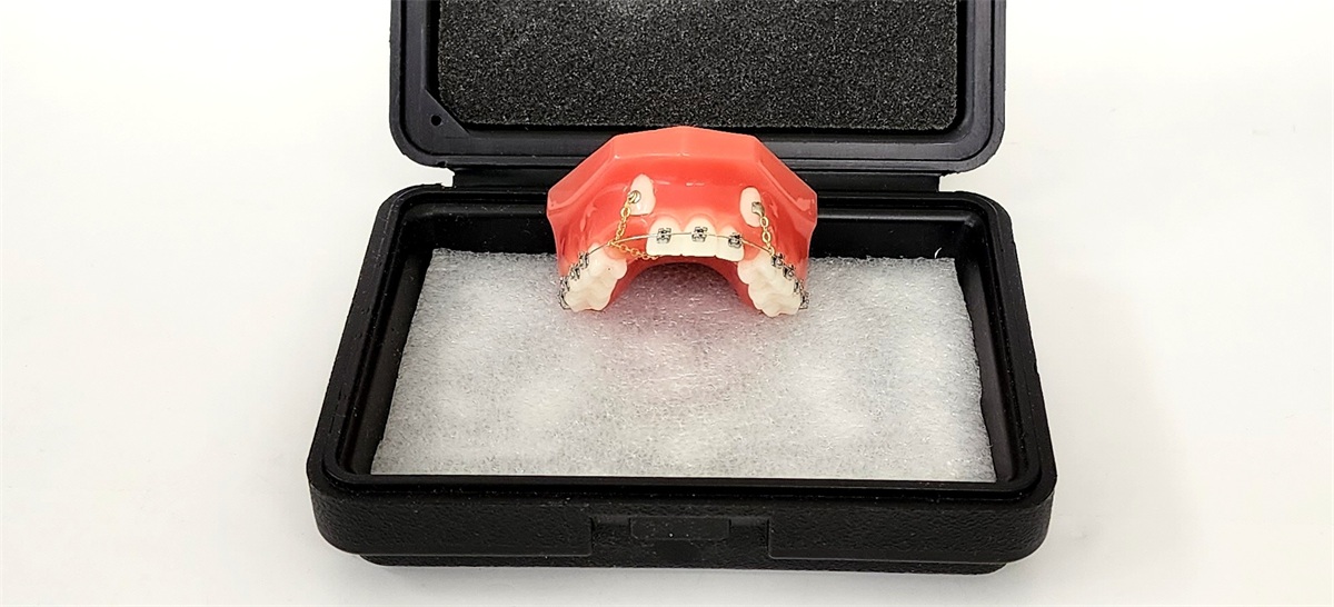 Cuspid Lok Models Orthodontic Demonstration And Treatment Solution Techniques