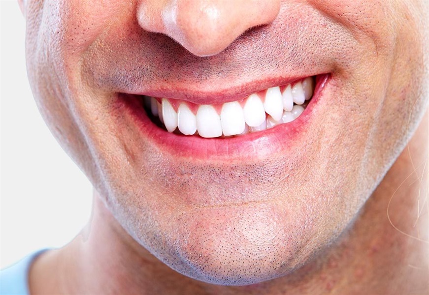 Why is the dental tourism so popular in Antalya Turkey