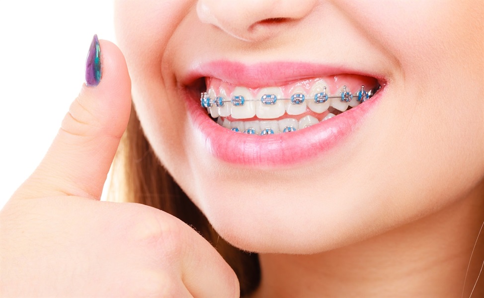 Orthodontics - Who Can Benefit From Orthodontic Treatment?