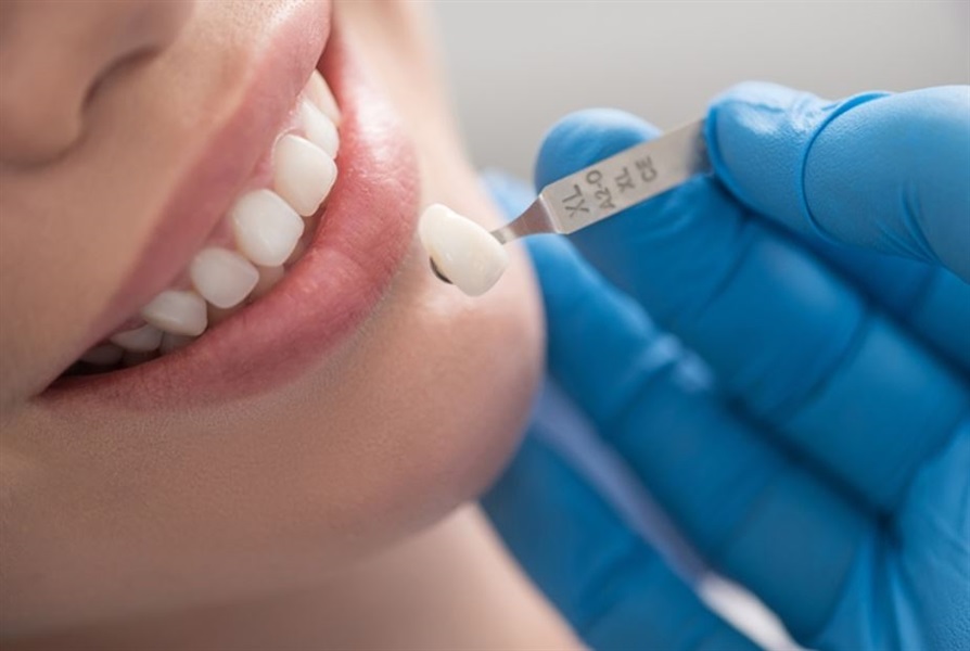 How long does a porcelain crown last?
