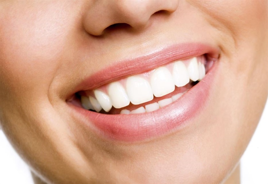 Teeth Whitening
