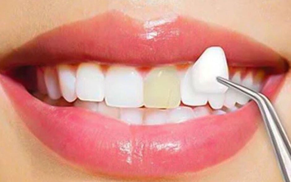 The Benefits of Cosmetic Dentistry