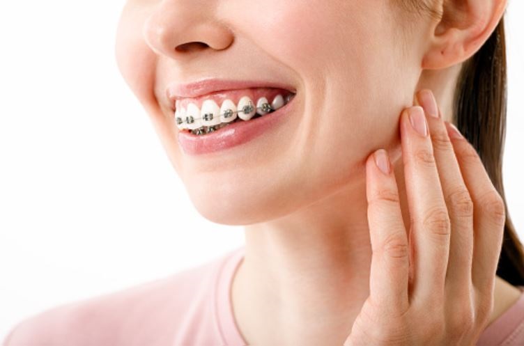Lingual Braces: A Inconspicuous Alternative to Traditional Metal Braces
