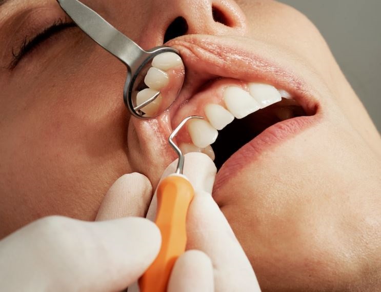 Importance of getting a dental cleaning