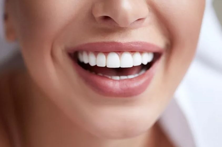 What are the types of veneers, how to choose